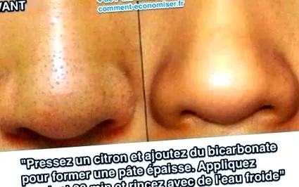 eltávolításán
