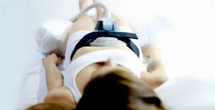 emsculpt slăbit