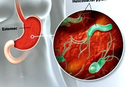 pylori