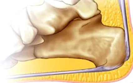 fascia patológia