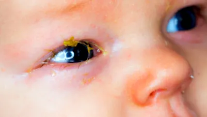 pediatre cred