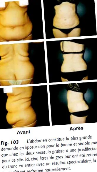 esthétique