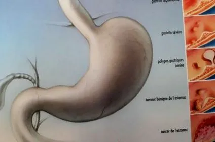 descrierea