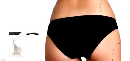 Fork Bikini