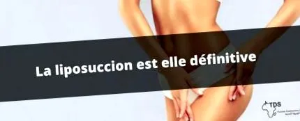 definitivă