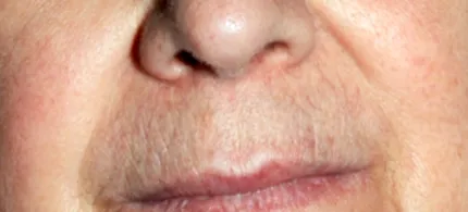 естетичний ellipse