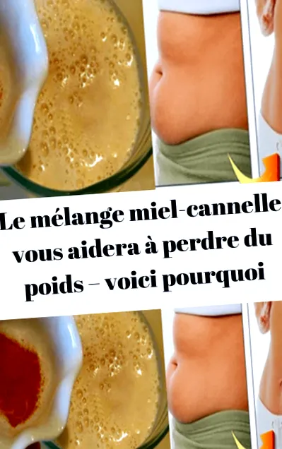 miere mixul