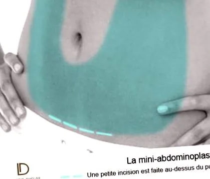 este