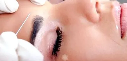 melyek