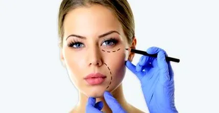 ridicarea blefaroplastia