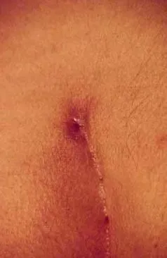 nyitott