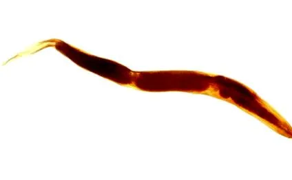 pinworm