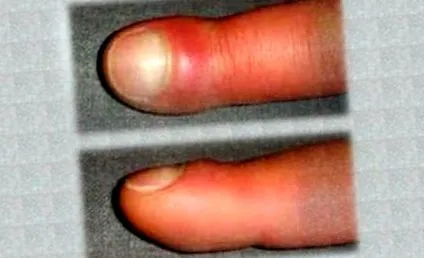 sănătatea