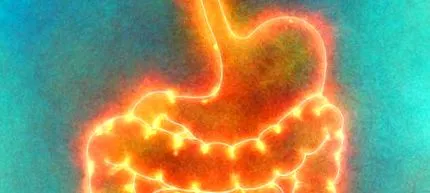ulcer