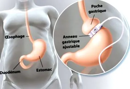 clinique clinique