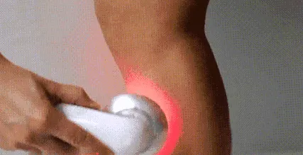 cellulit