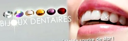 dentare bijuterii