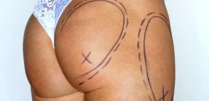 este