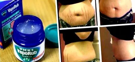 vicks vicks