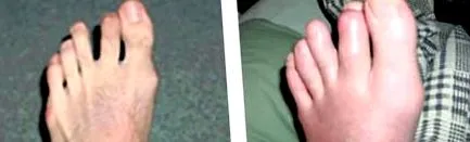 лікувати лікувати