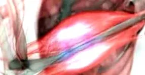 auriolban