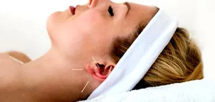 eficientă acupunctura