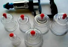 cupping