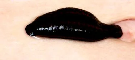 leírása