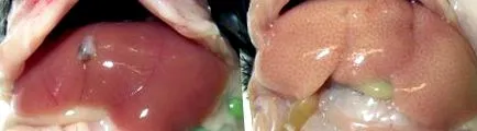 steatosis