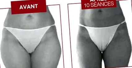slimming