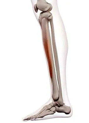 tibial