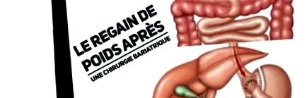 chirurgicală după