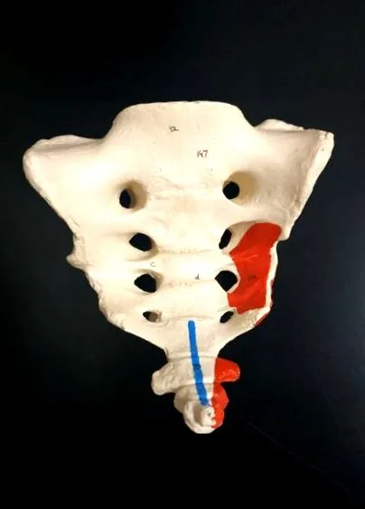 coccydynia