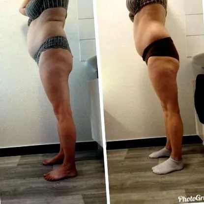 before-after
