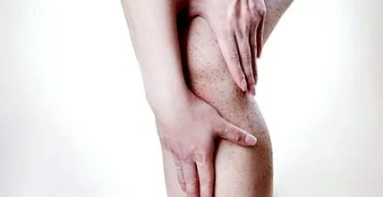 anti-cellulit