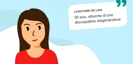 degenerativă degenerativă