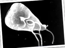 sant giardiasis