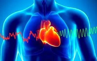 cardiacă