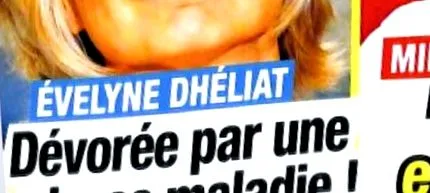 dhéliat