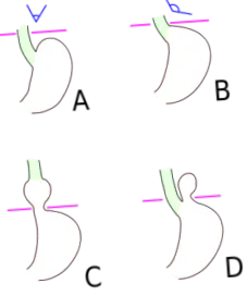 simptome