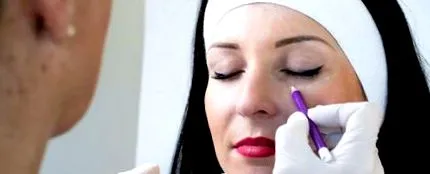 hialuronic