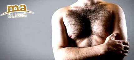 gynecomastia férfiak számára