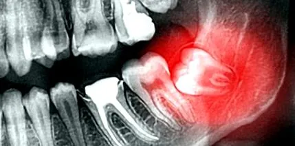 dentară imagistica