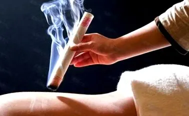 moxibustion