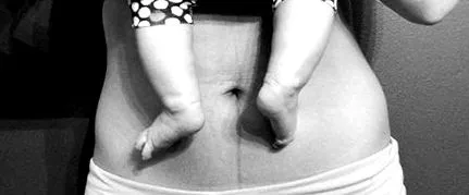 takebackpostpartum
