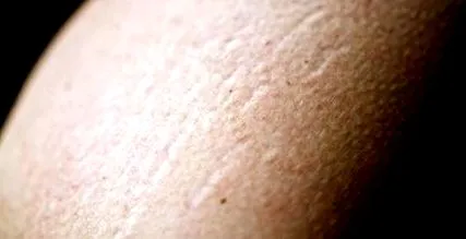 stilurilor