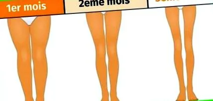 dormi