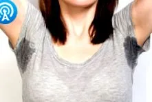 hyperhidrosis