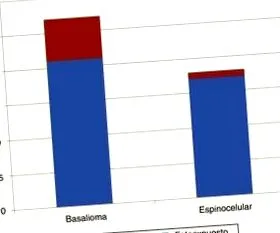 melanoma