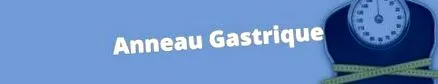 intervenție